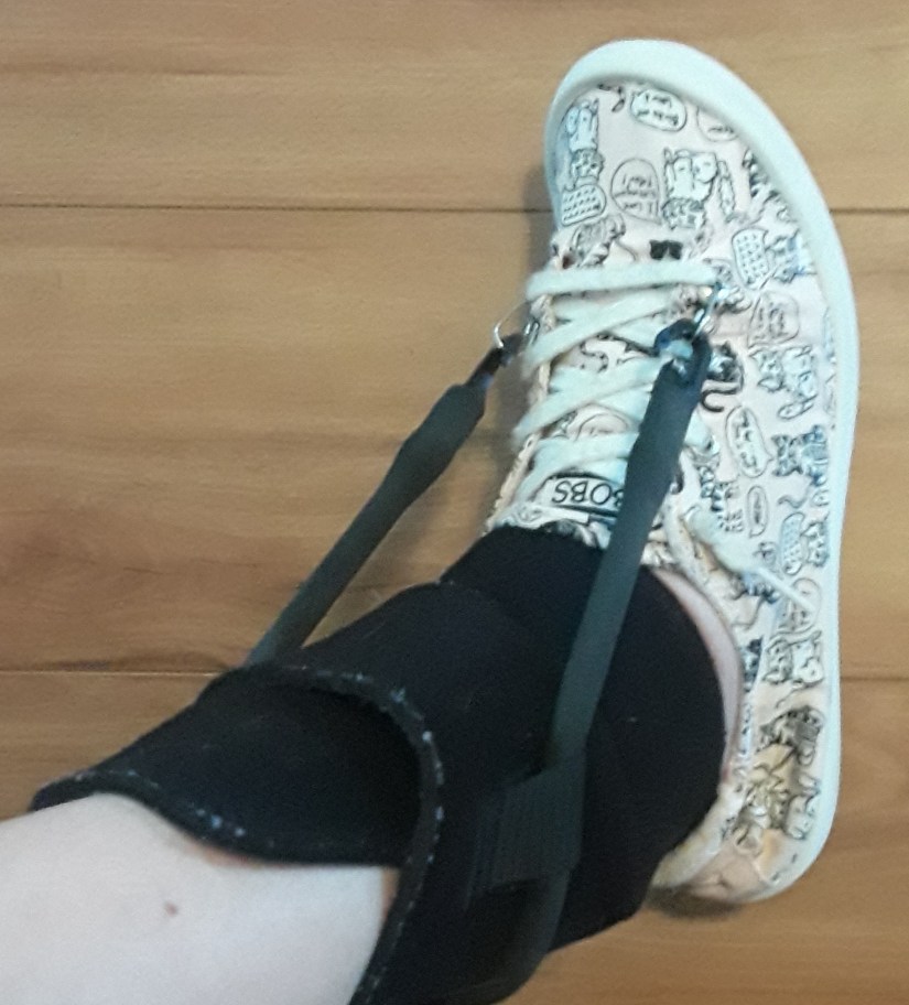 core products drop foot brace